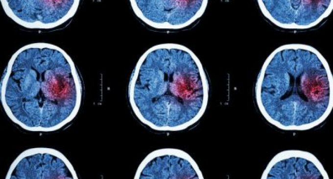 New technology could dramatically shorten diagnosis time of stroke patients