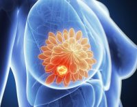 FDA accepts regulatory submission for Lynparza in metastatic breast cancer