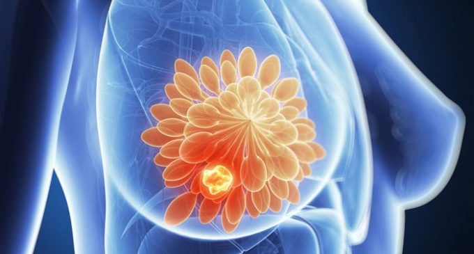 FDA accepts regulatory submission for Lynparza in metastatic breast cancer