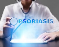 Janssen announces FDA approval of Stelara for plaque psoriasis