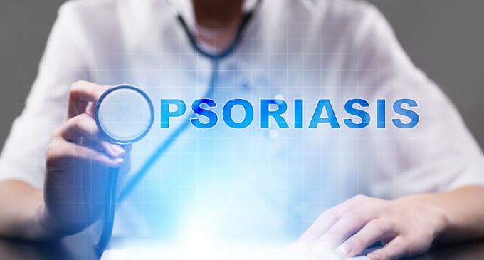 Janssen announces FDA approval of Stelara for plaque psoriasis